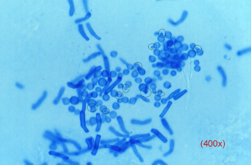 Cultivo Bacteriano (Dermatofitos)