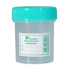 RECOLECTOR DE ORINA PLASTIONCE